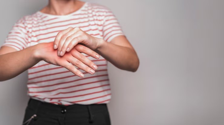 mitos asam urat, jari tangan tidak bisa ditekuk, gejala asam urat sebenarnya, kesehatan ibu muda, sendi kaku dan nyeri, pencegahan asam urat, makanan tinggi purin, trigger finger, arthritis